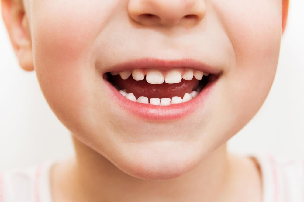 Il fluoro fa bene ai denti. A quelli di tutti, anche dei bambini