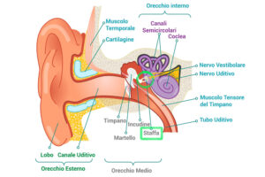 otosclerosi